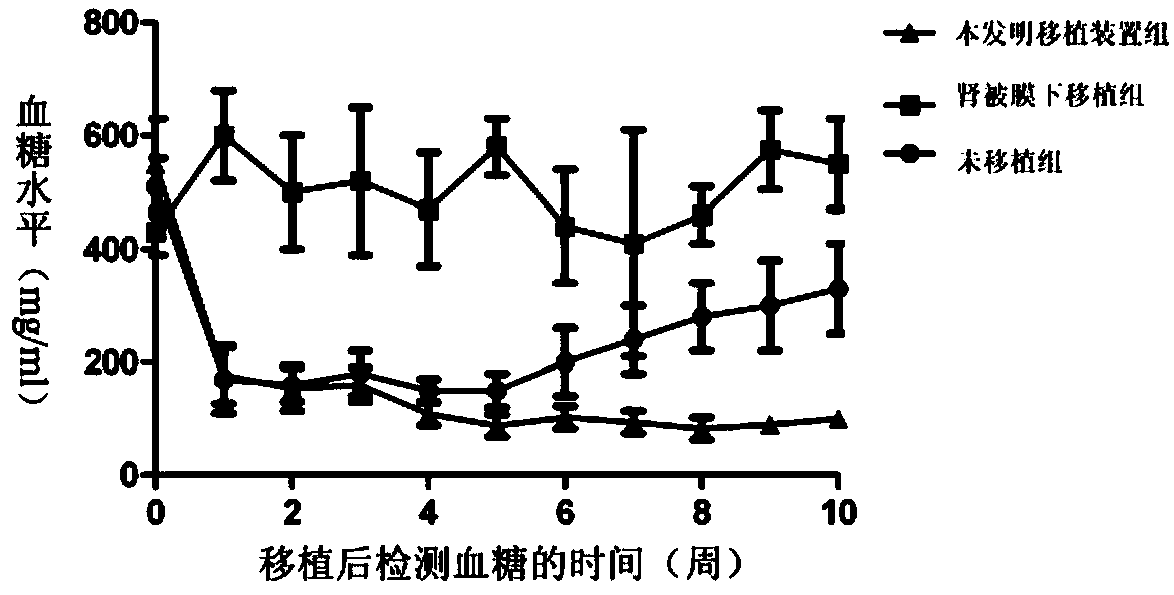 A kind of cell transplantation synergistic protection device and preparation method thereof