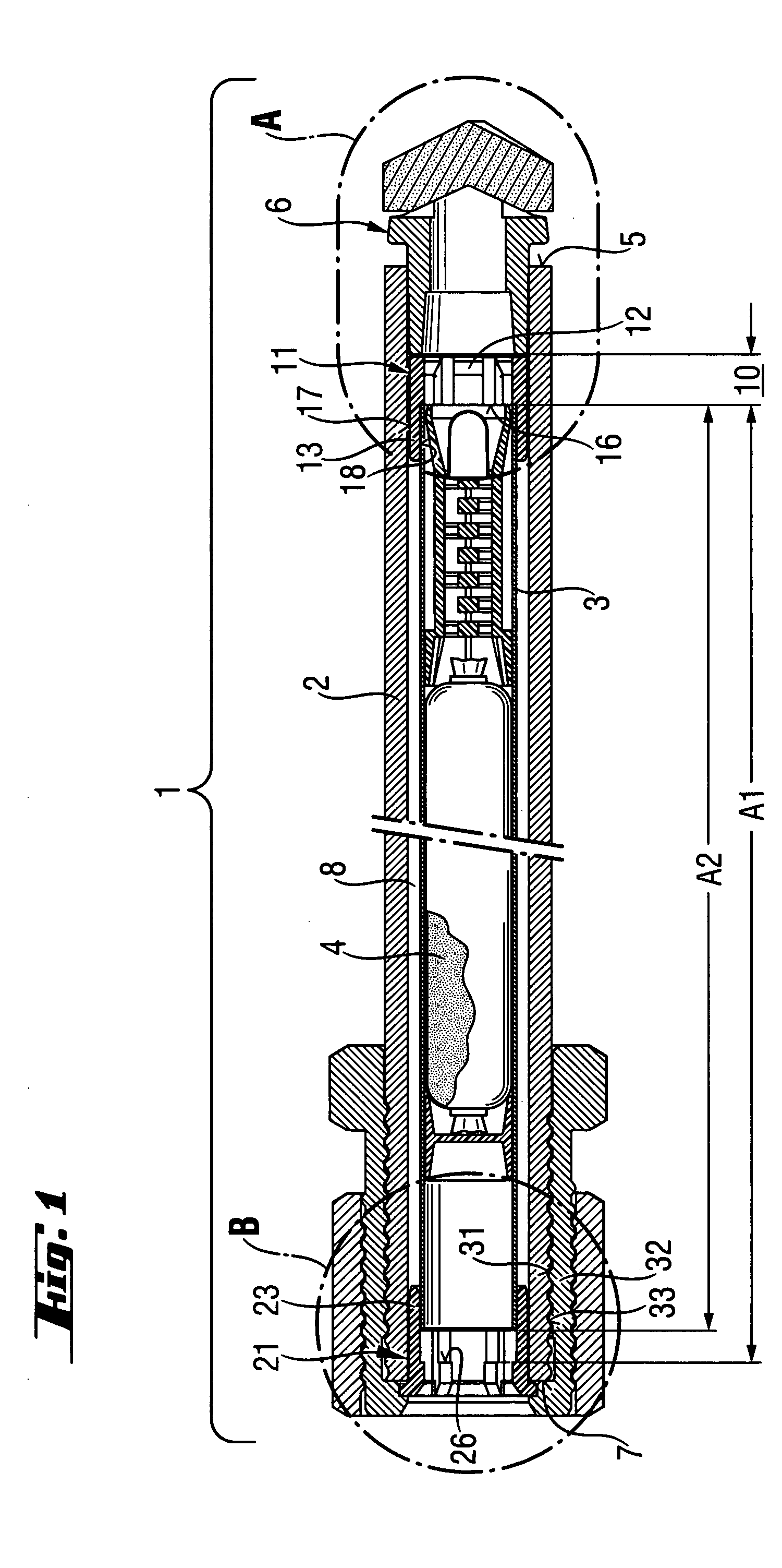 Bonding anchor