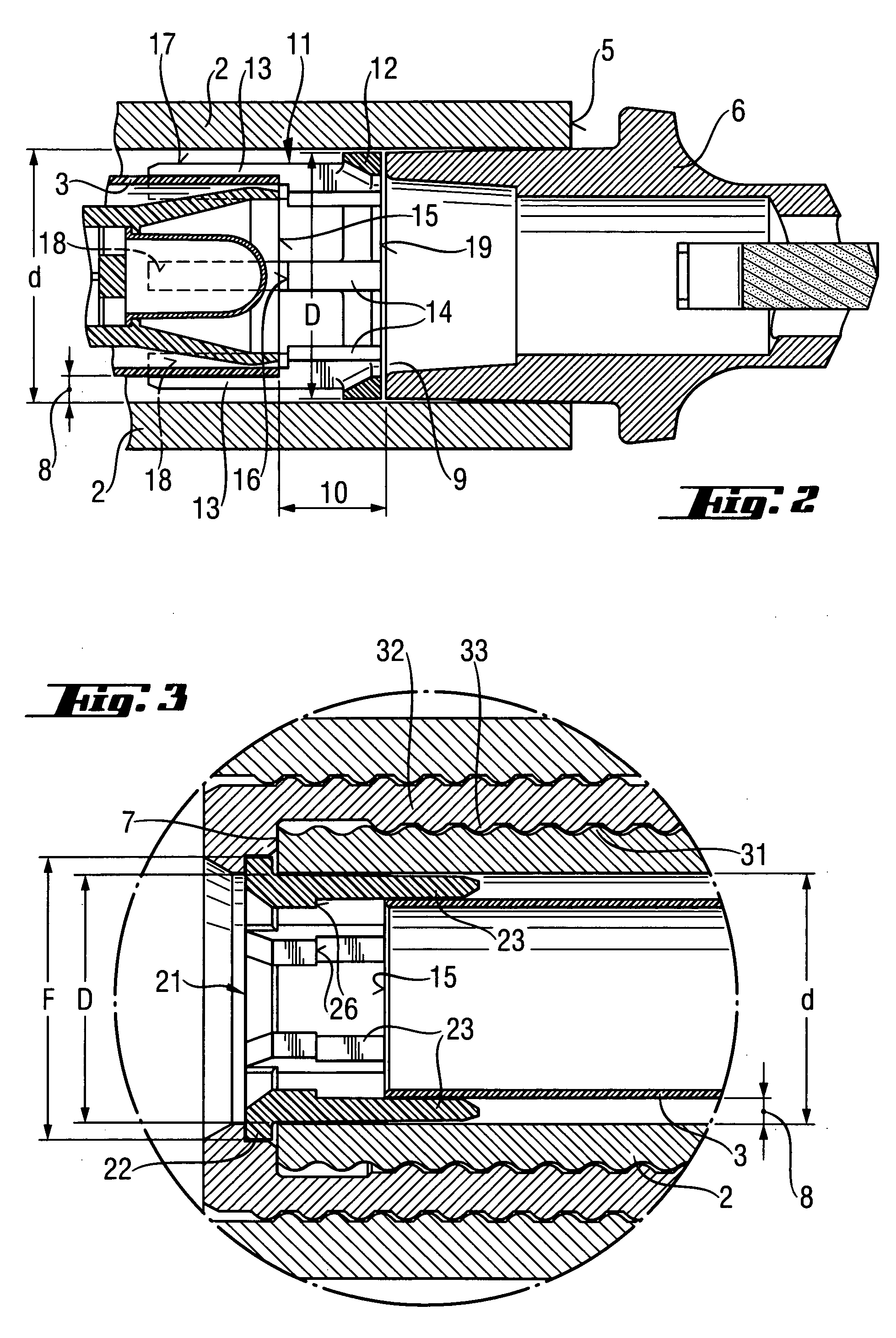 Bonding anchor