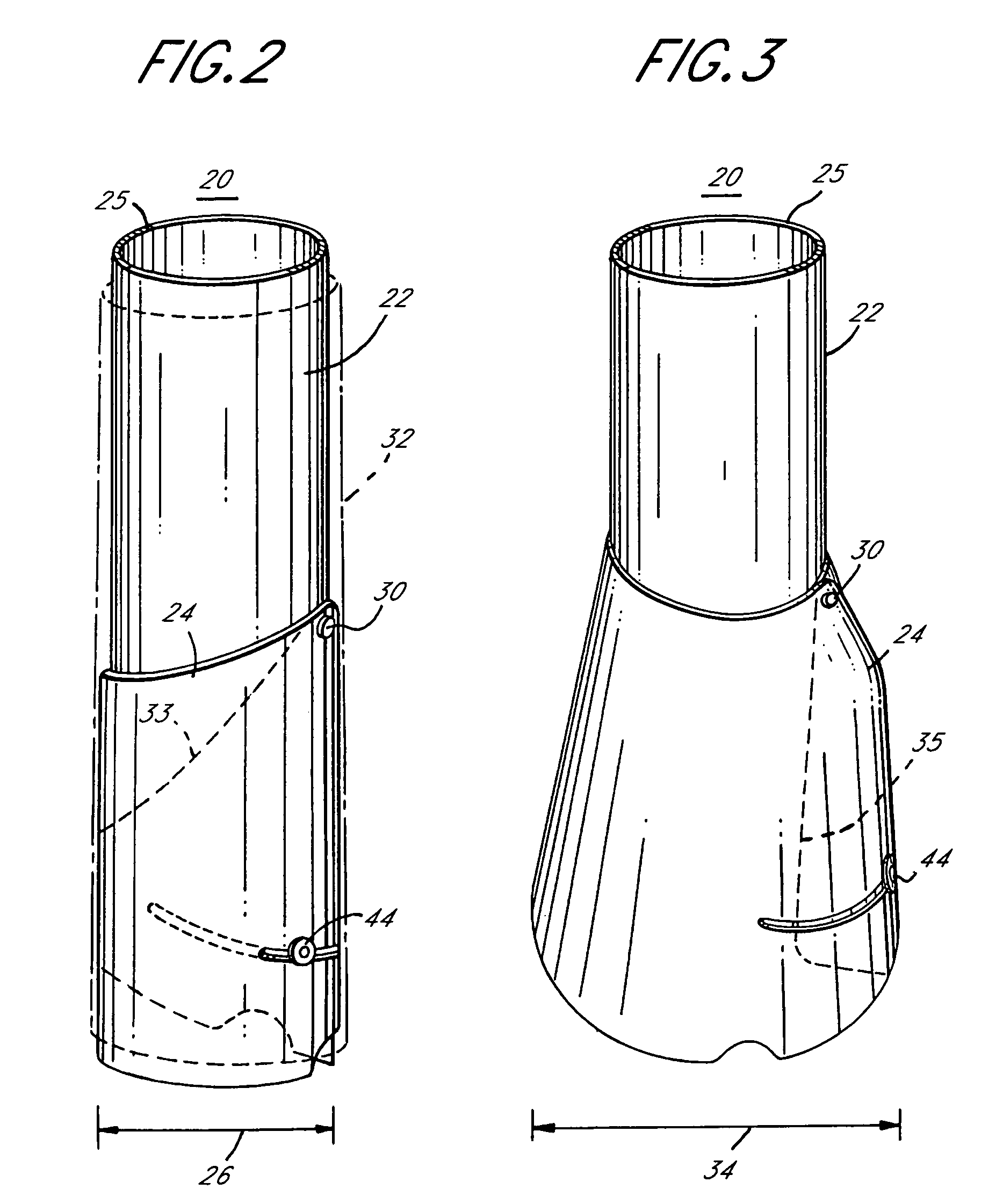 Adjustable height access device for treating the spine of a patient