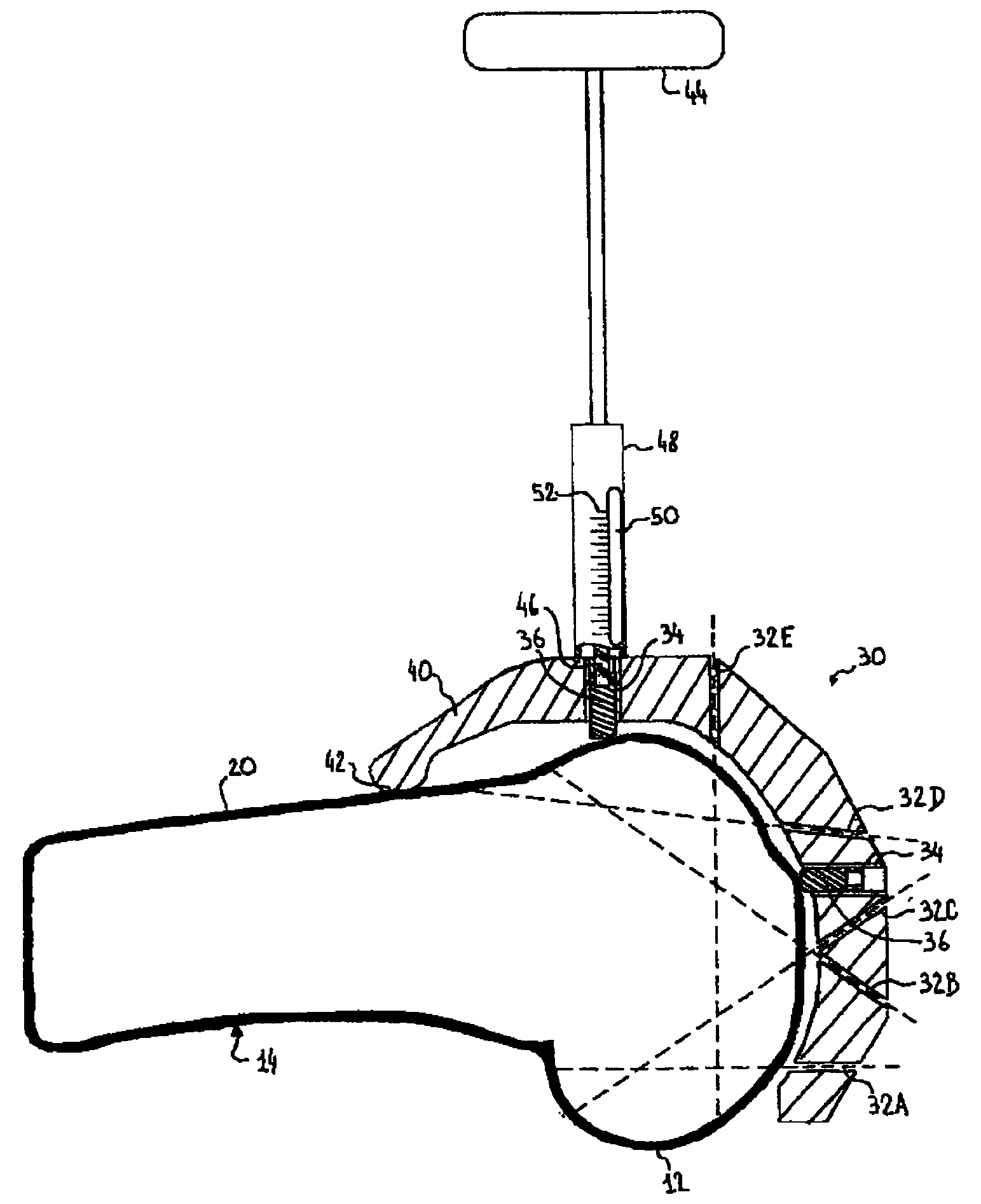 Device for positioning a bone cutting guide