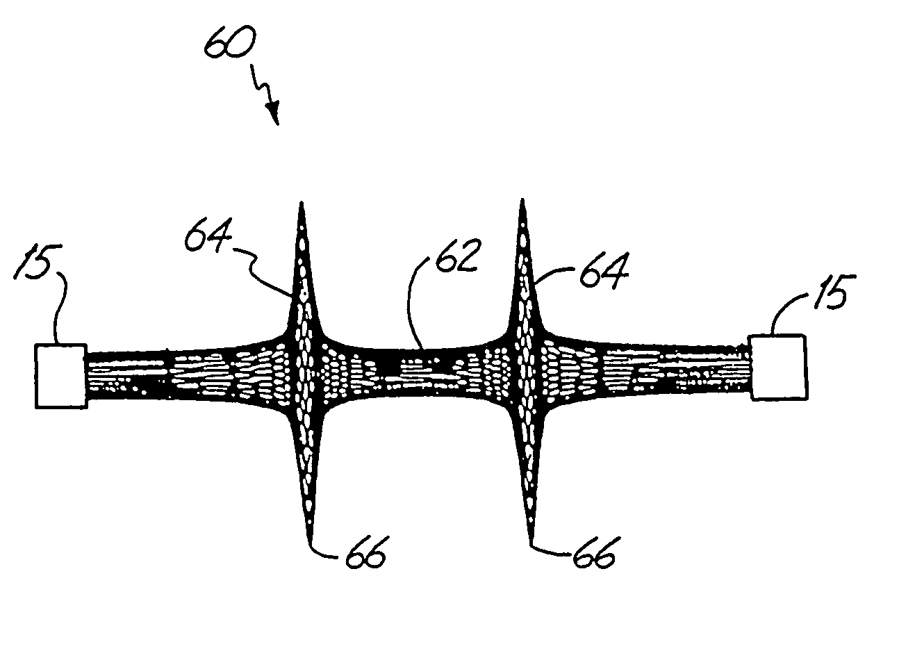 Method and device for filtering body fluid