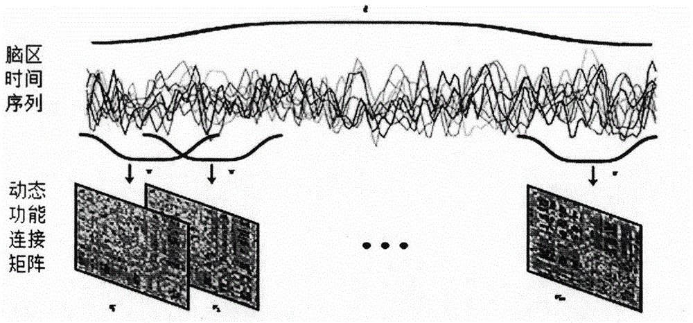 Method for extracting and classifying fMRI features based on adaptive entropy algorithm for projection clustering (APEC)