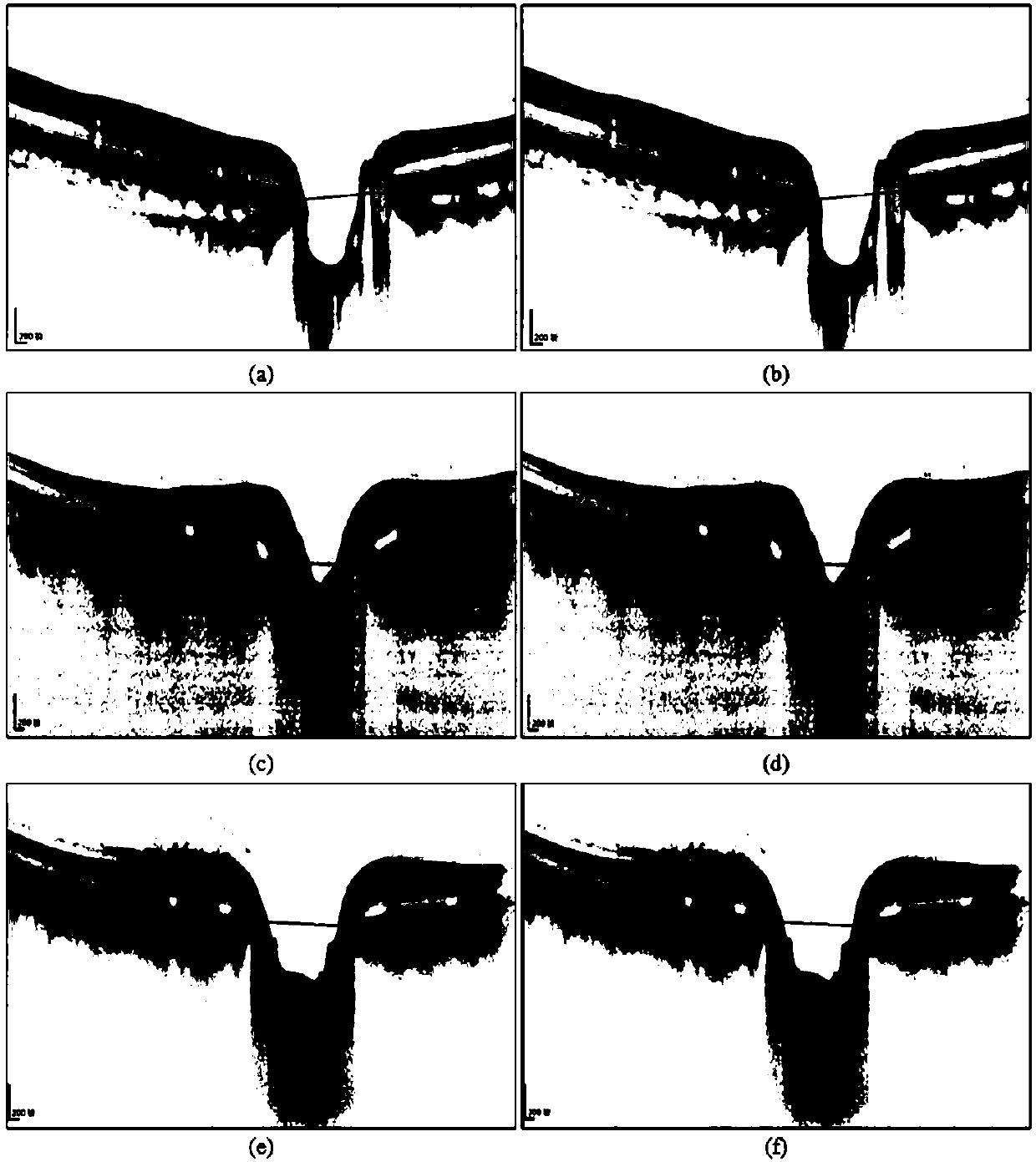 Method for measuring depth of front surface of lamina cribrosa based on active contour and energy constraint