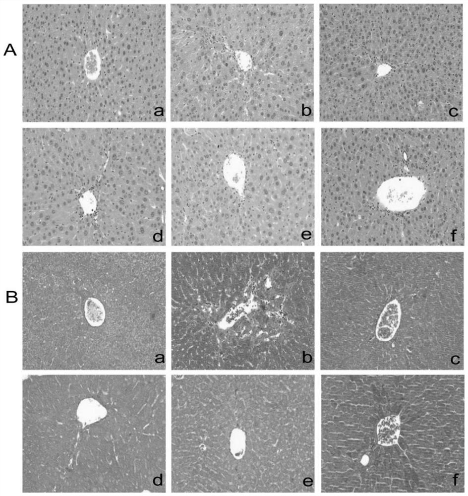 Application of tiarella polyphylla alcohol extract in preparation of drugs for treating or protecting and regulating hepatic fibrosis diseases