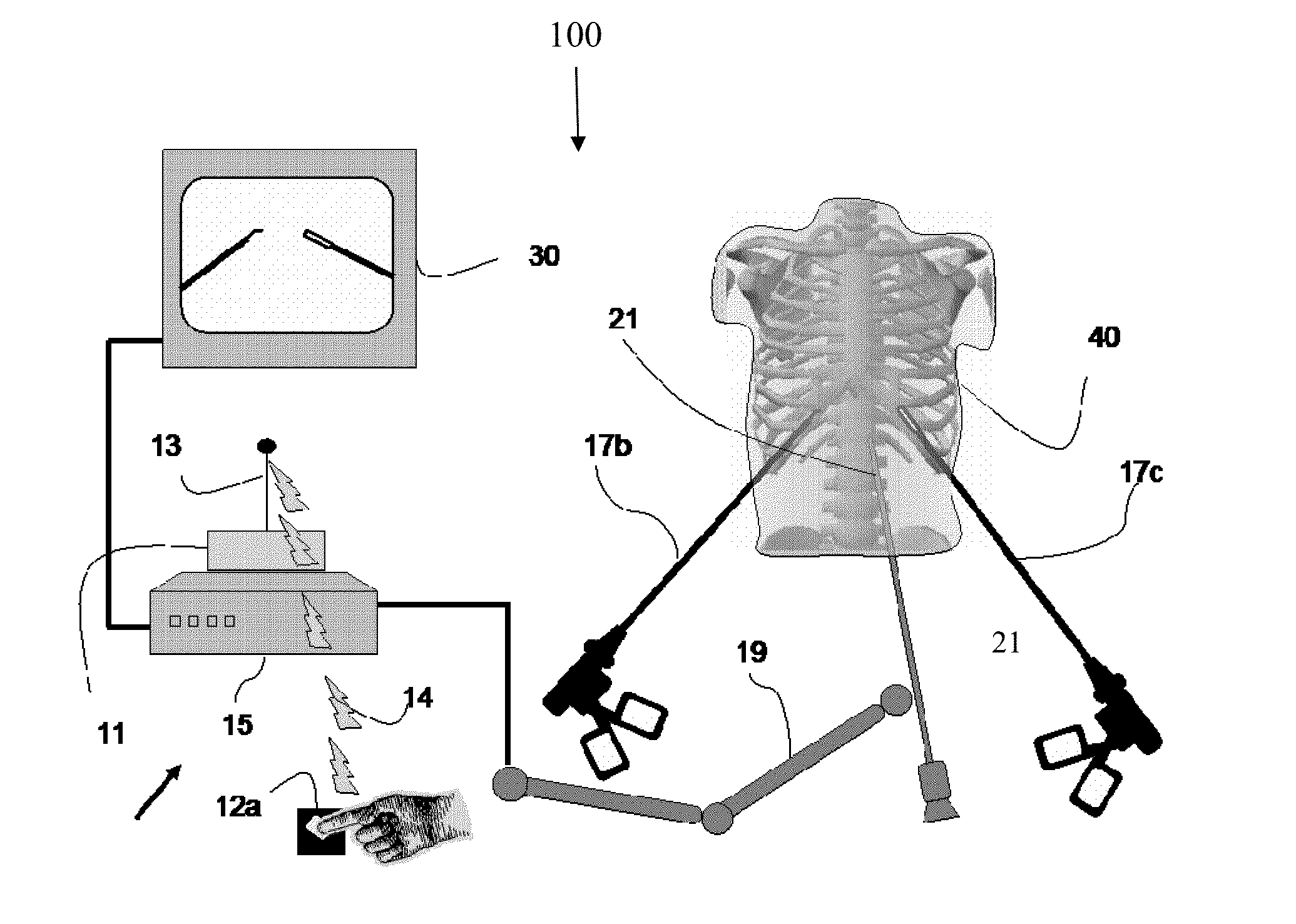 Device and method for asissting laparoscopic surgery rule based approach