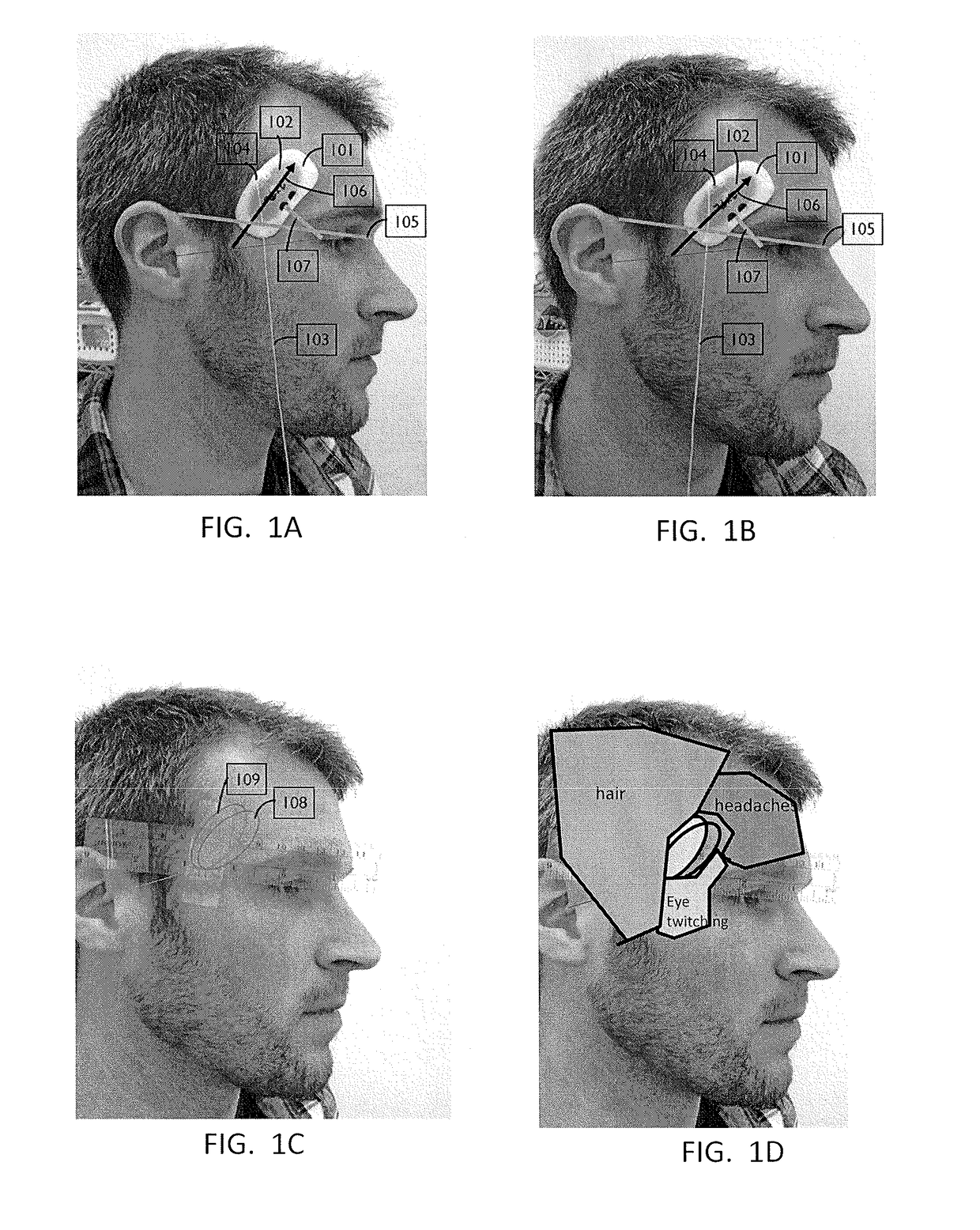 Apparatuses and methods for transdermal electrical stimulation of nerves to modify or induce a cognitive state