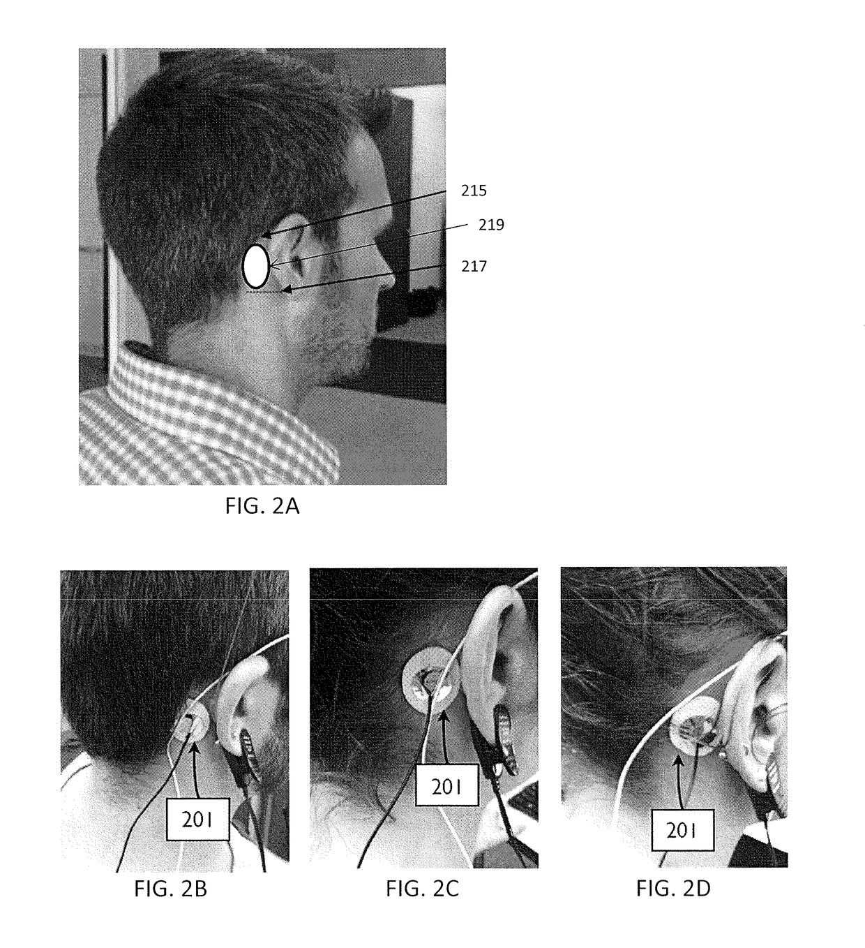 Apparatuses and methods for transdermal electrical stimulation of nerves to modify or induce a cognitive state