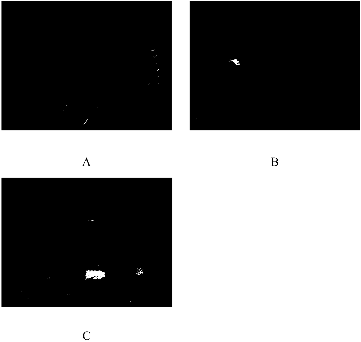 A method for induction and differentiation of leaf callus of saline-alkali-tolerant fast-growing Ulmus ulma clone