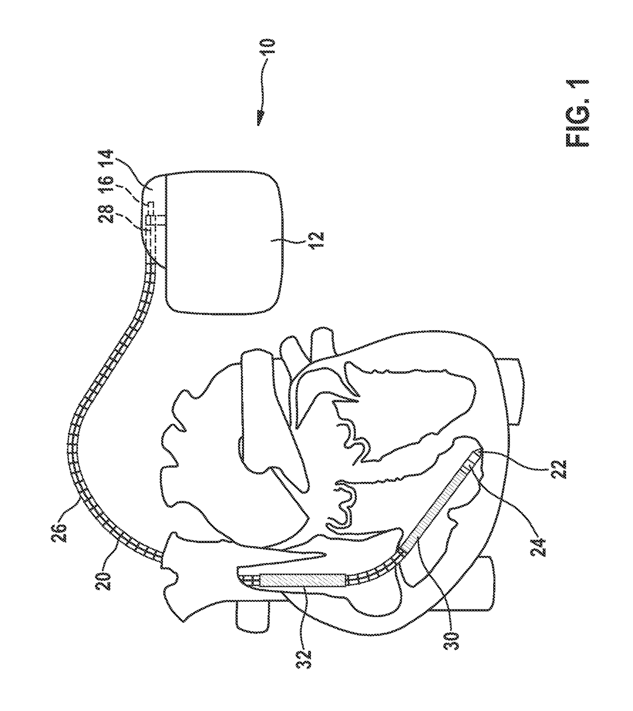 Implantable device