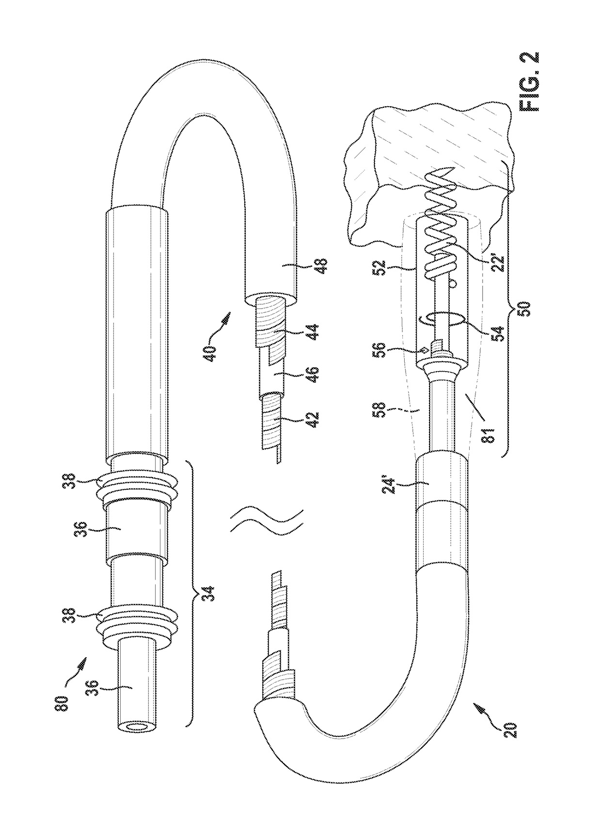 Implantable device