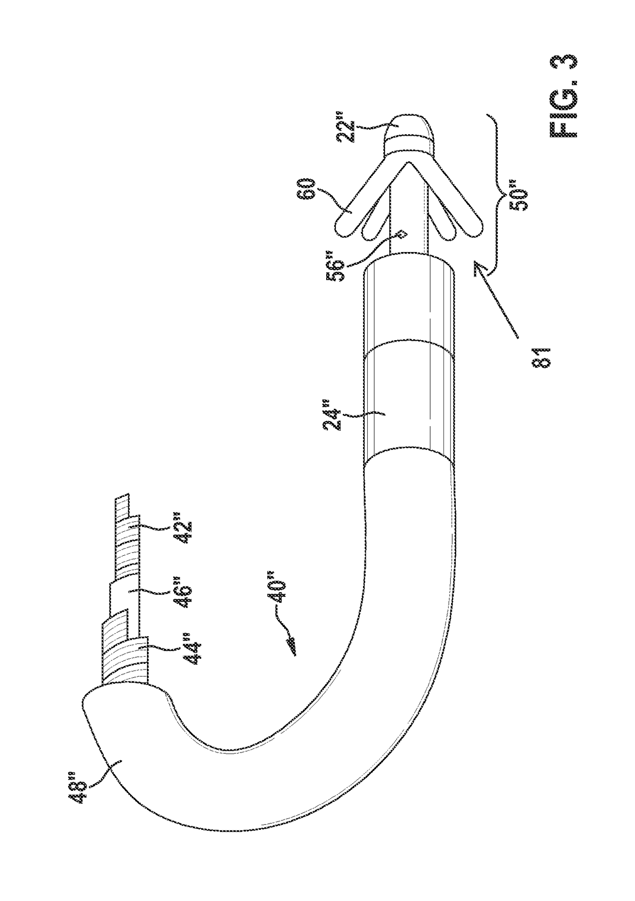 Implantable device