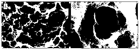 Preparation method of titanium implant surface with micro-nano composite structure