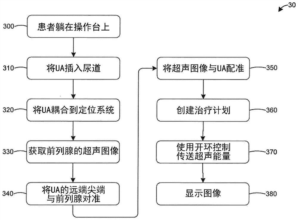 Systems and methods for open-loop ultrasound therapy