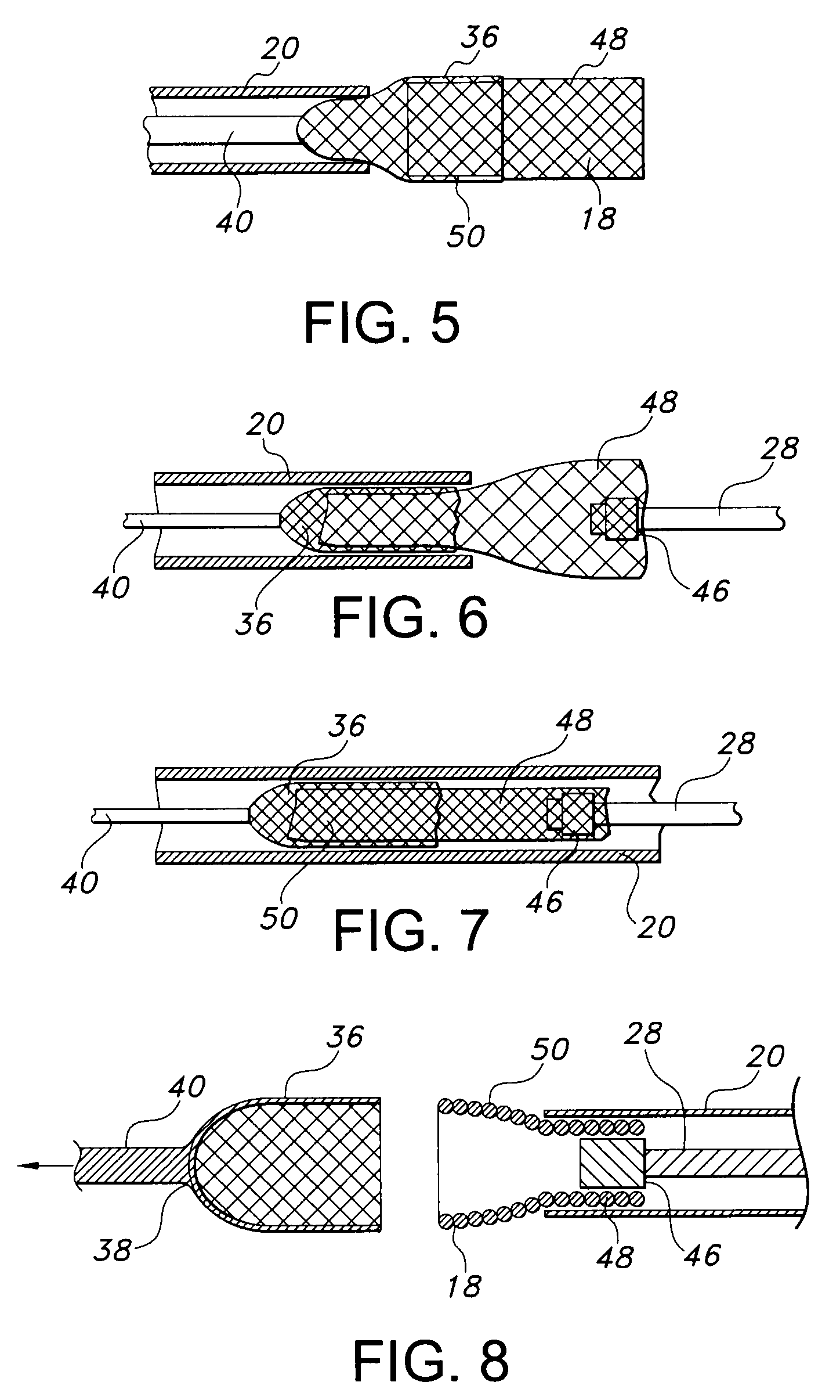 Prosthesis loading delivery and deployment apparatus