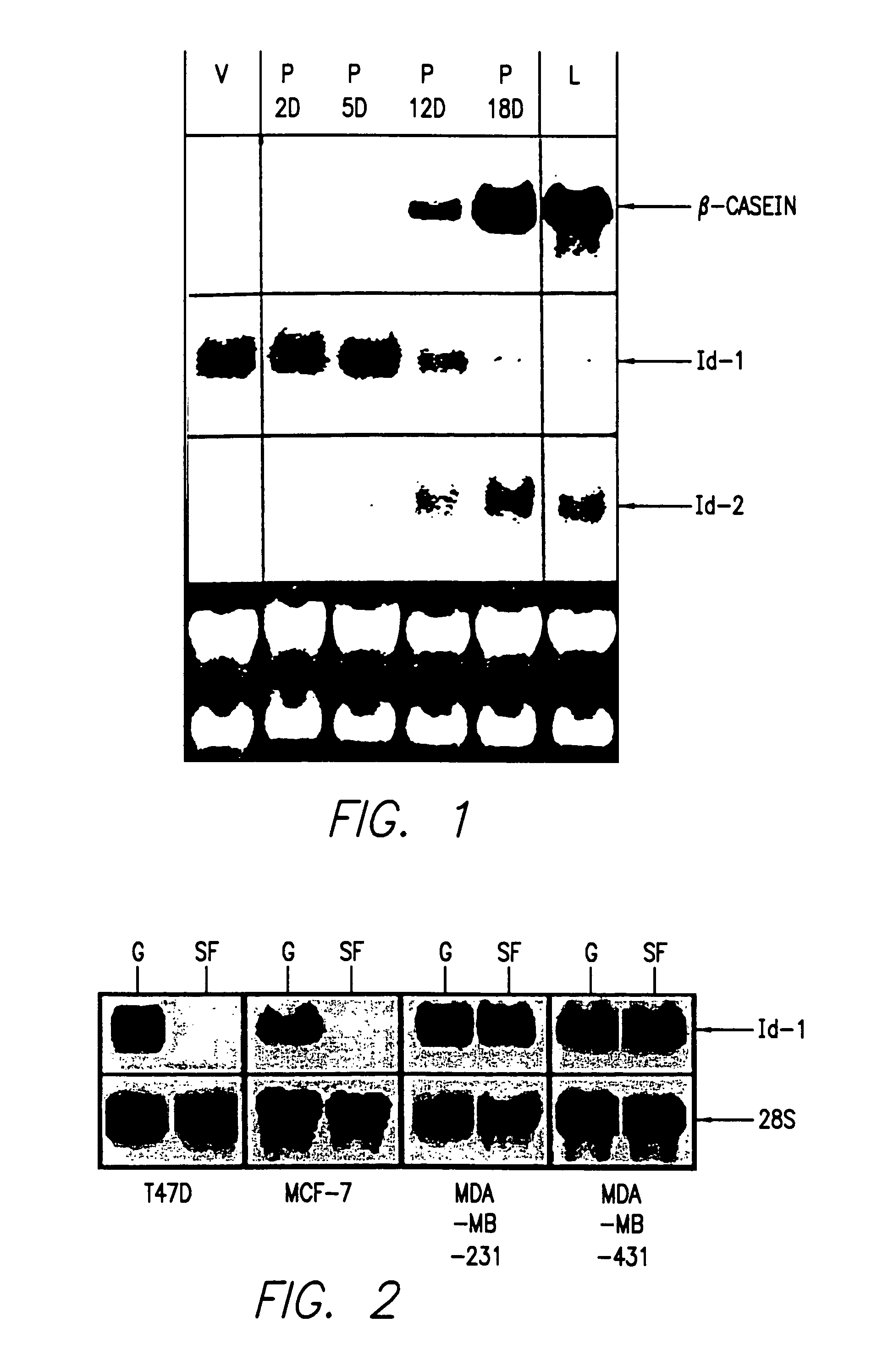 Id-1 and Id-2 genes and products as markers of epithelial cancer