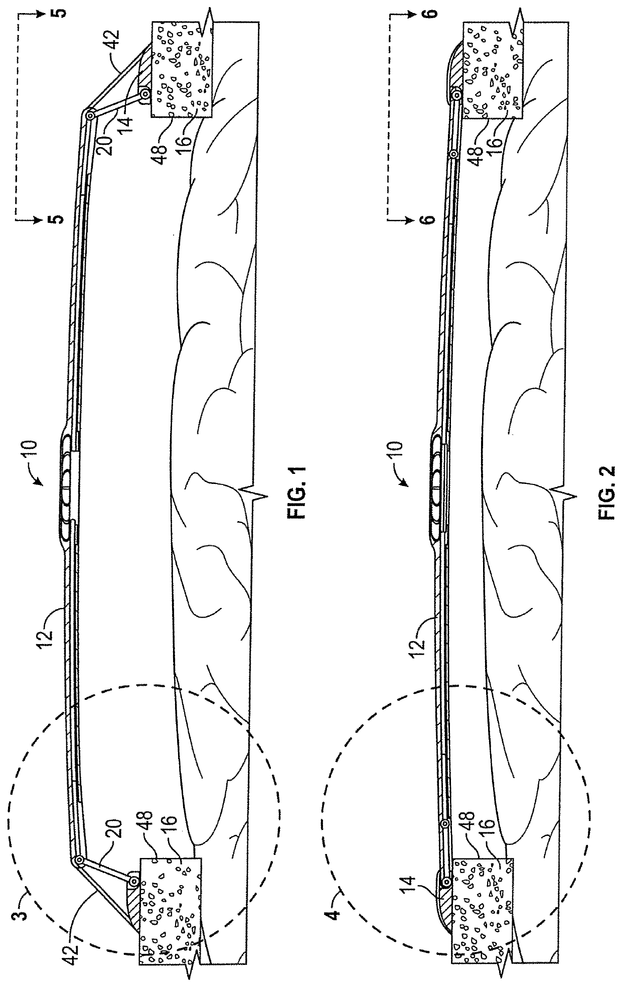 Cranioplasty plate assembly with pivotal struts