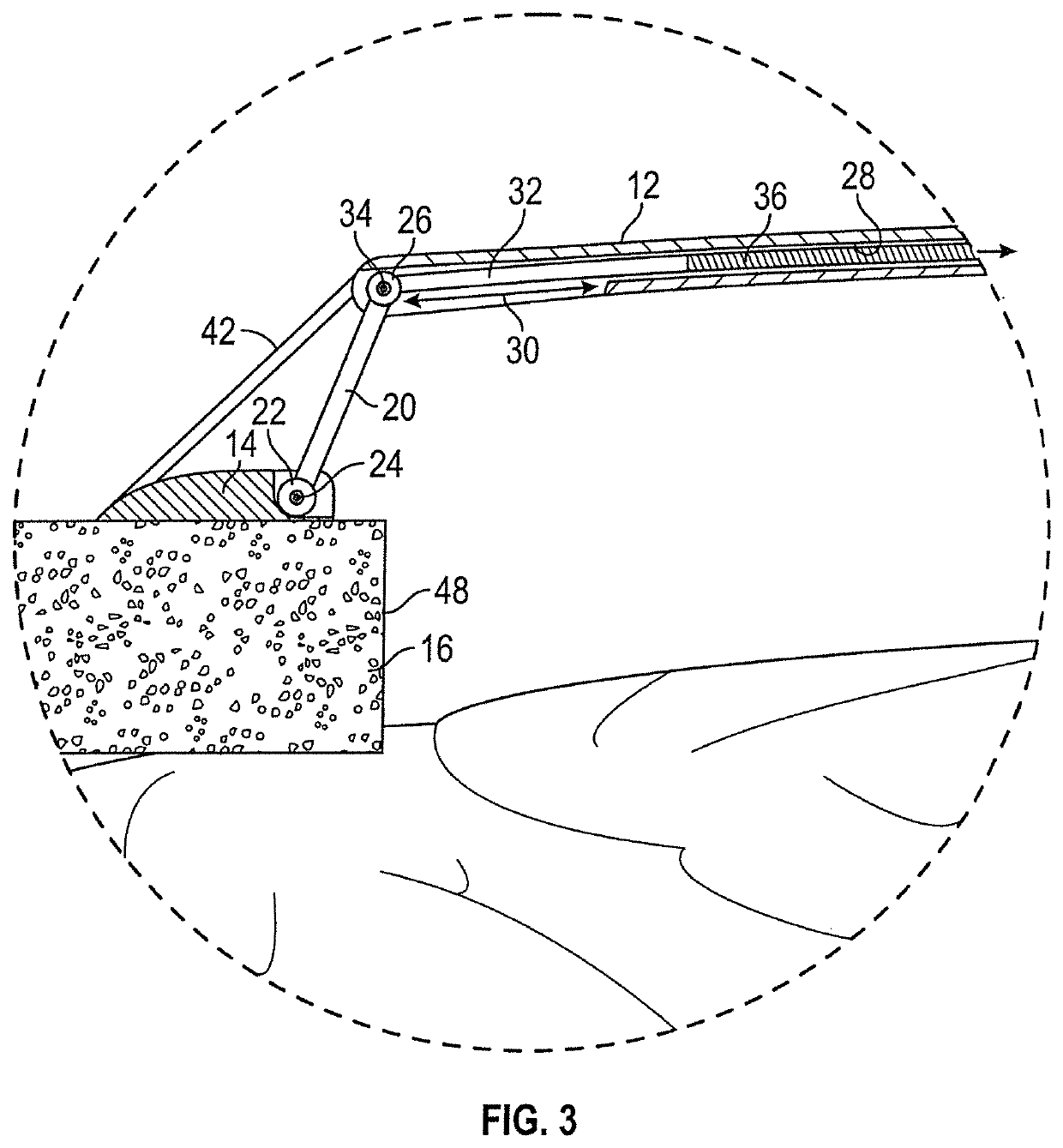 Cranioplasty plate assembly with pivotal struts