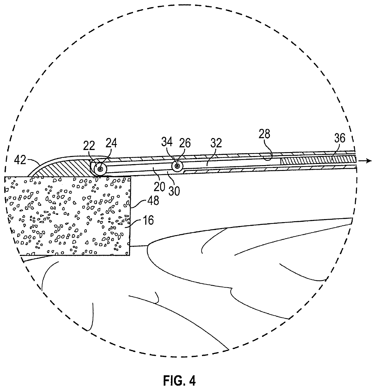 Cranioplasty plate assembly with pivotal struts