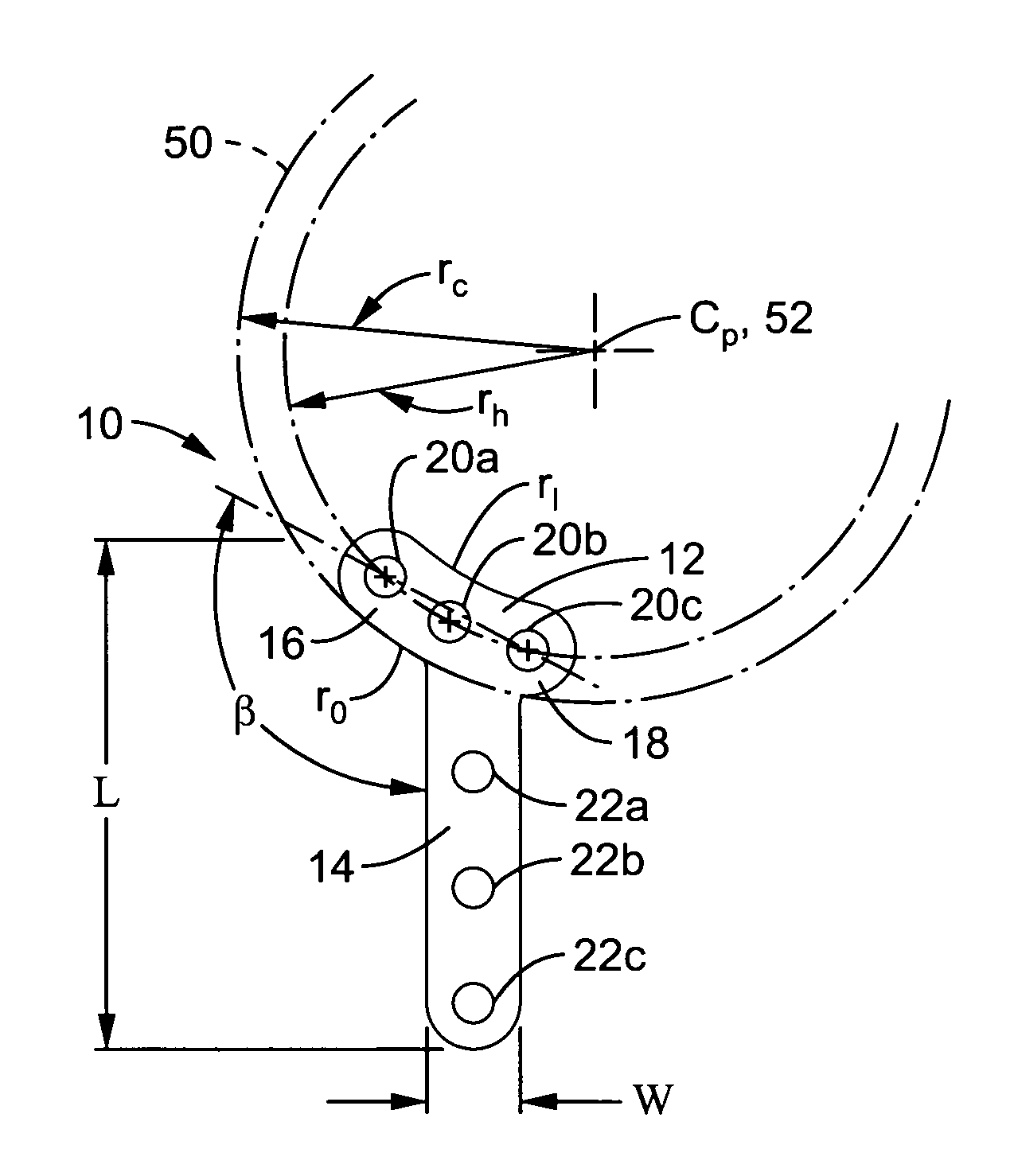 Apparatus and methods for tibial plateau leveling osteotomy