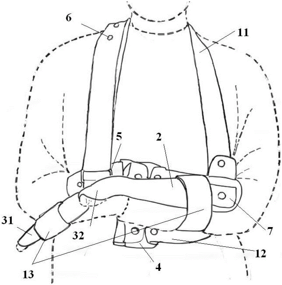 Pronated deformity orthopedic appliance for upper limbs