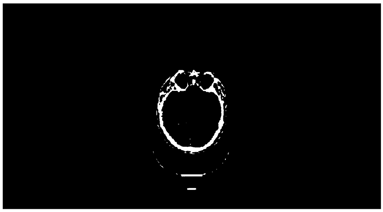 Image segmentation method based on 3D voxel data image and equipment