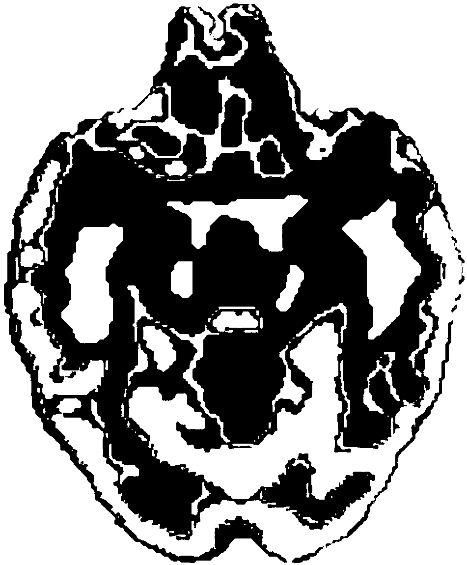 Image segmentation method based on 3D voxel data image and equipment