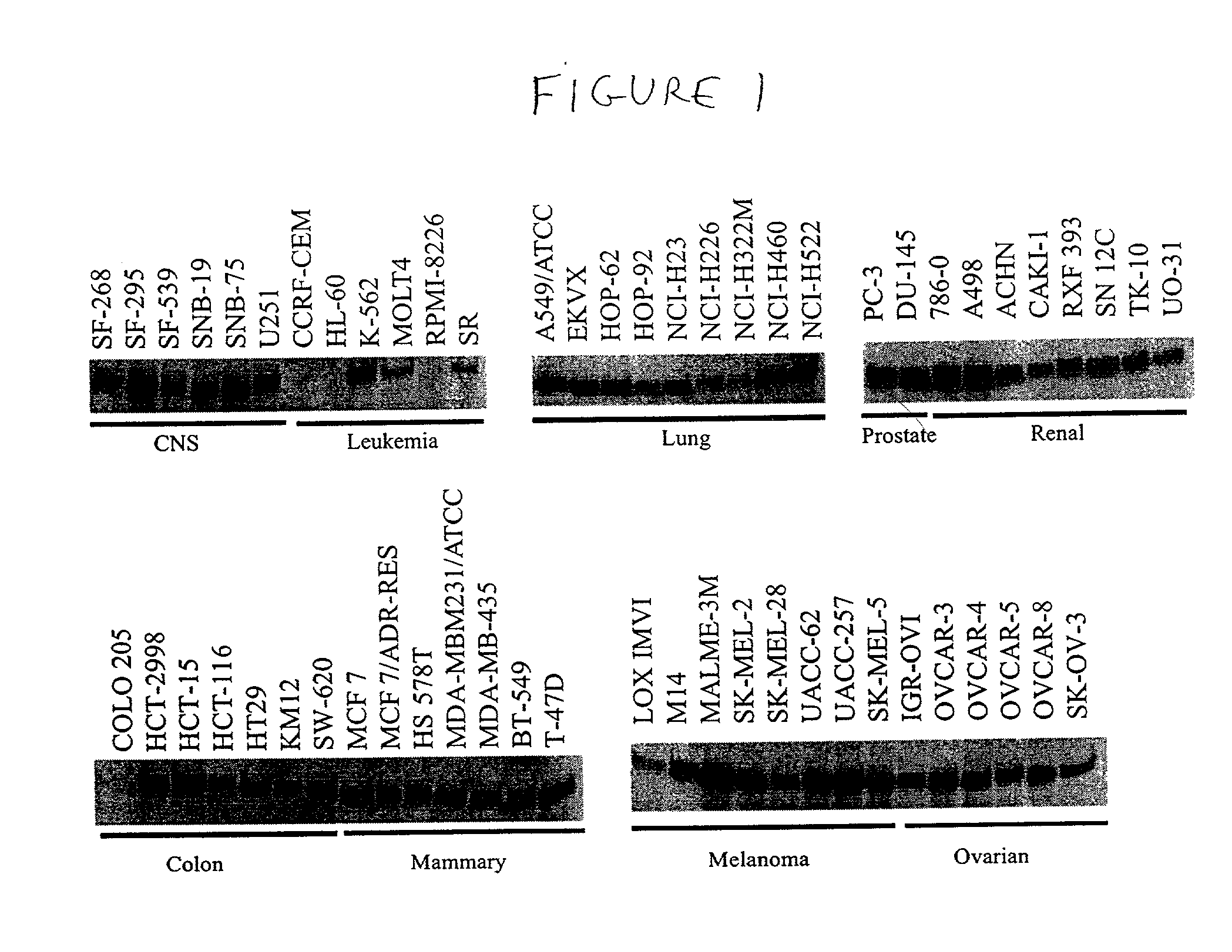 HIP1 cancer markers