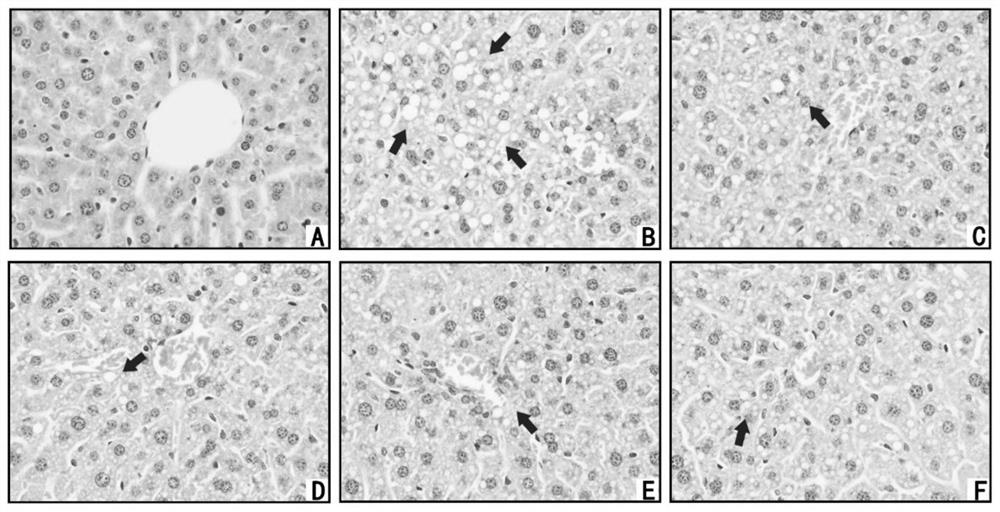 Novel application of rendan mini-pill traditional Chinese medicine composition in alleviation of hangover or treatment of alcoholic liver injury