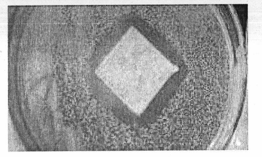 Antibacterial fibre containing nano-metal, fabric and wound dressing, and preparation method thereof