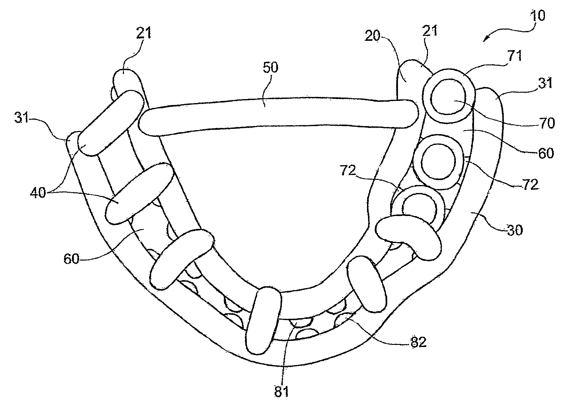 Surgical template for performing dental implantology