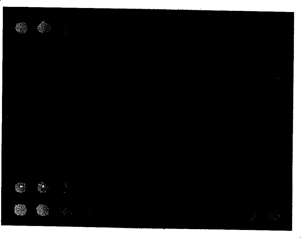 Gene chips for detecting of pathogens of sexually transmitted diseases and reagent kit for detecting