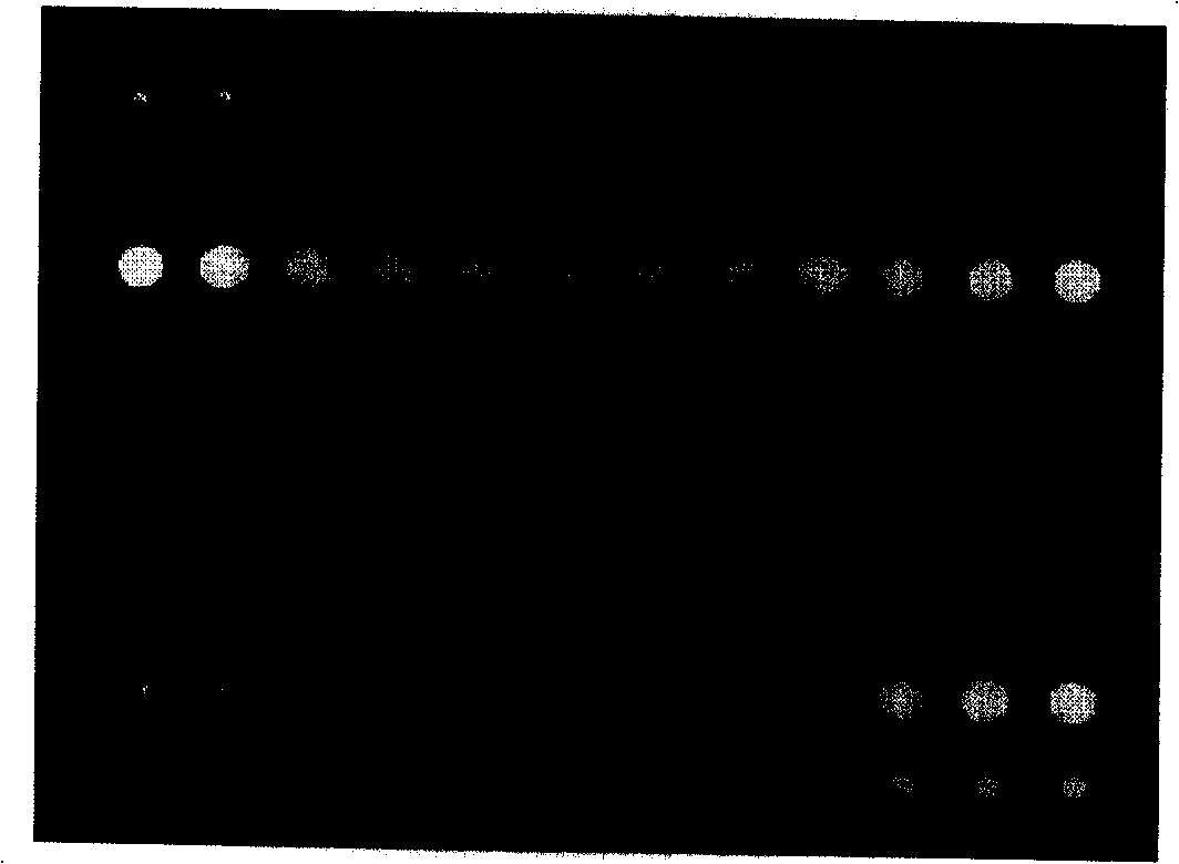 Gene chips for detecting of pathogens of sexually transmitted diseases and reagent kit for detecting