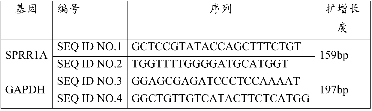 Application of sprr1a gene in preparation of osteoarthritis diagnostic products