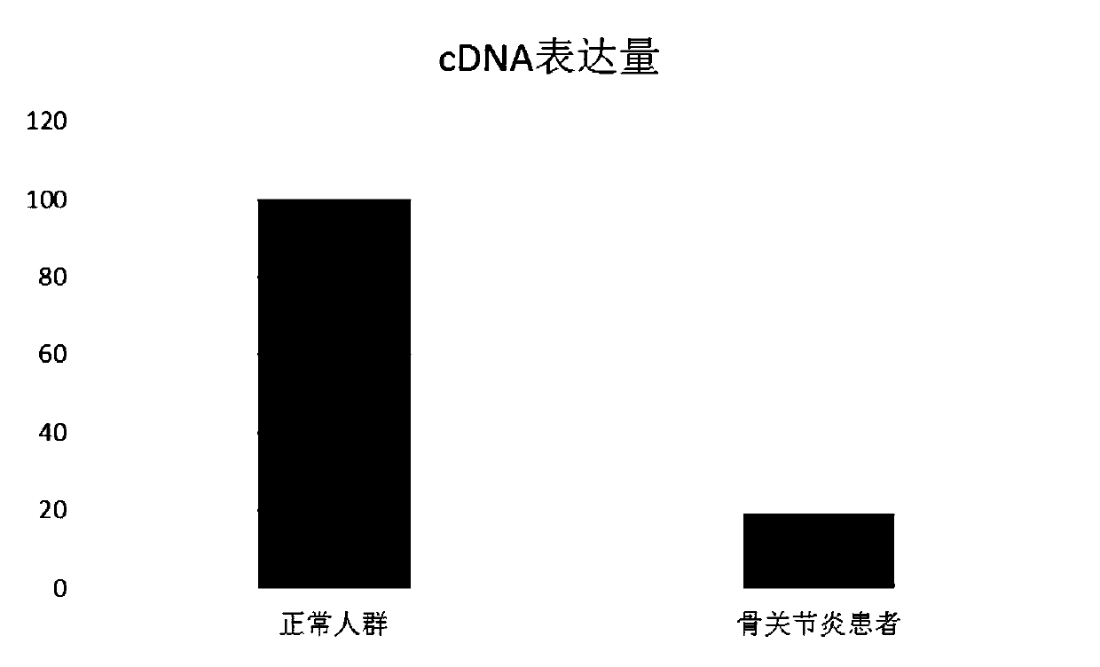 Application of sprr1a gene in preparation of osteoarthritis diagnostic products