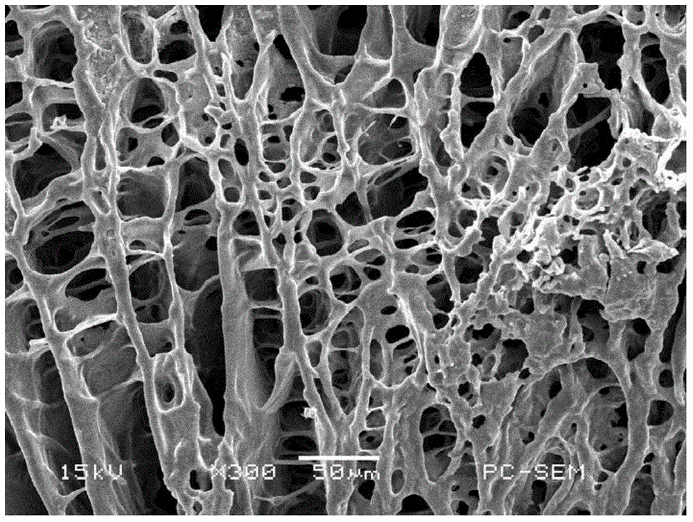 Method for preparing nano-compound antibacterial dressing