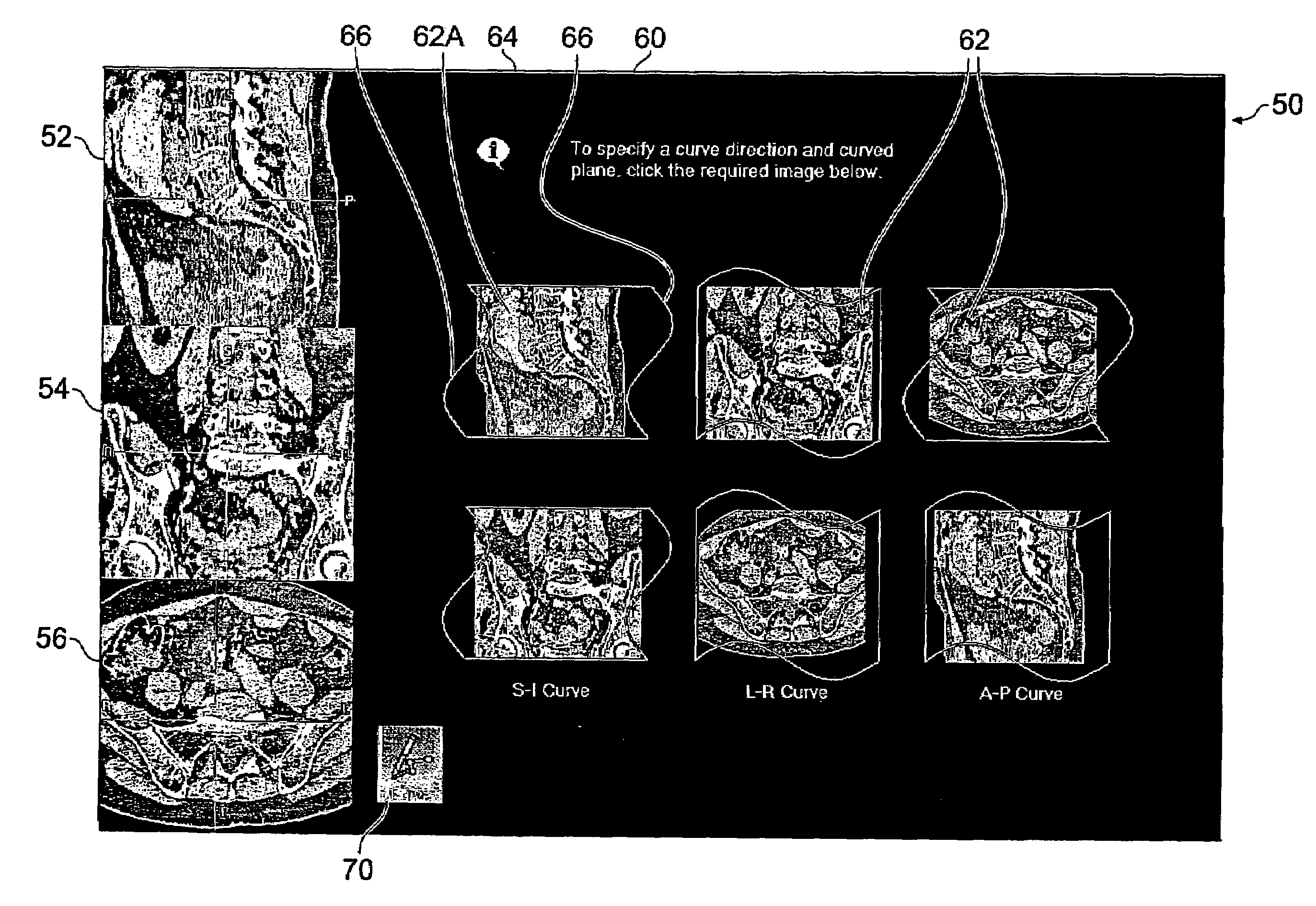 User-interface and method for curved multi-planar reformatting of three-dimensional volume data sets