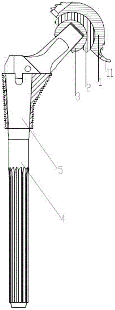 Hip joint prosthesis