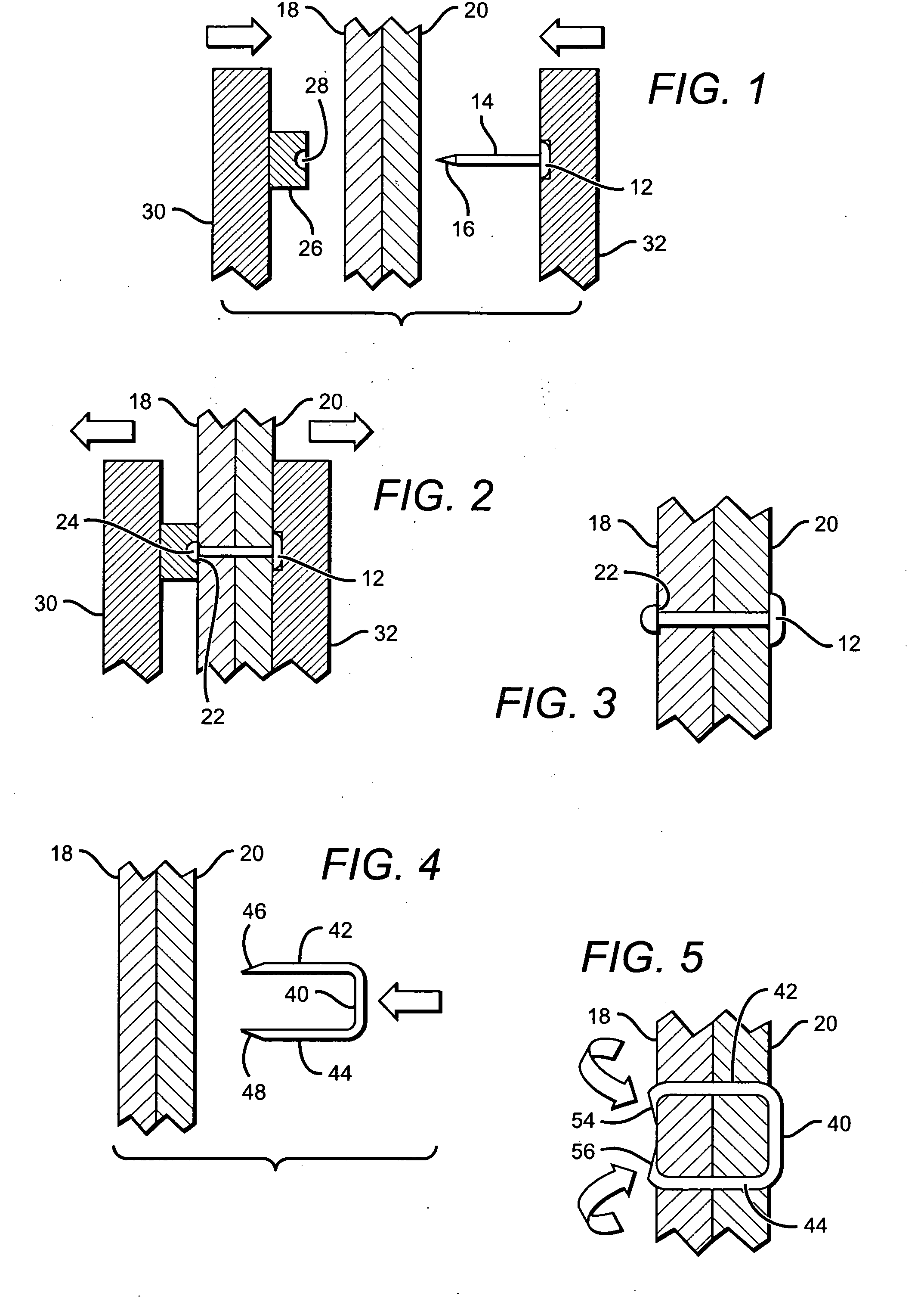 Tissue holding implants