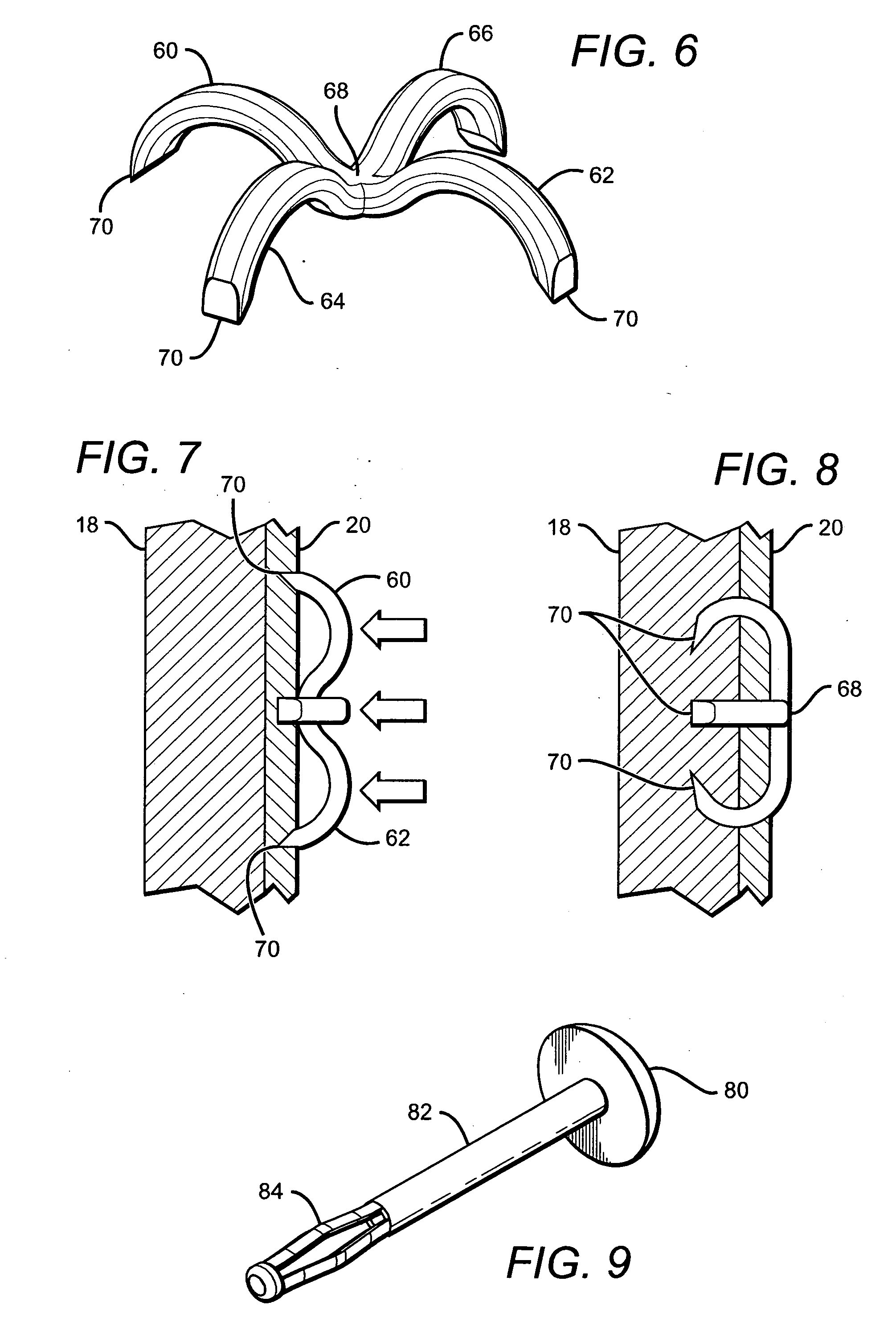 Tissue holding implants