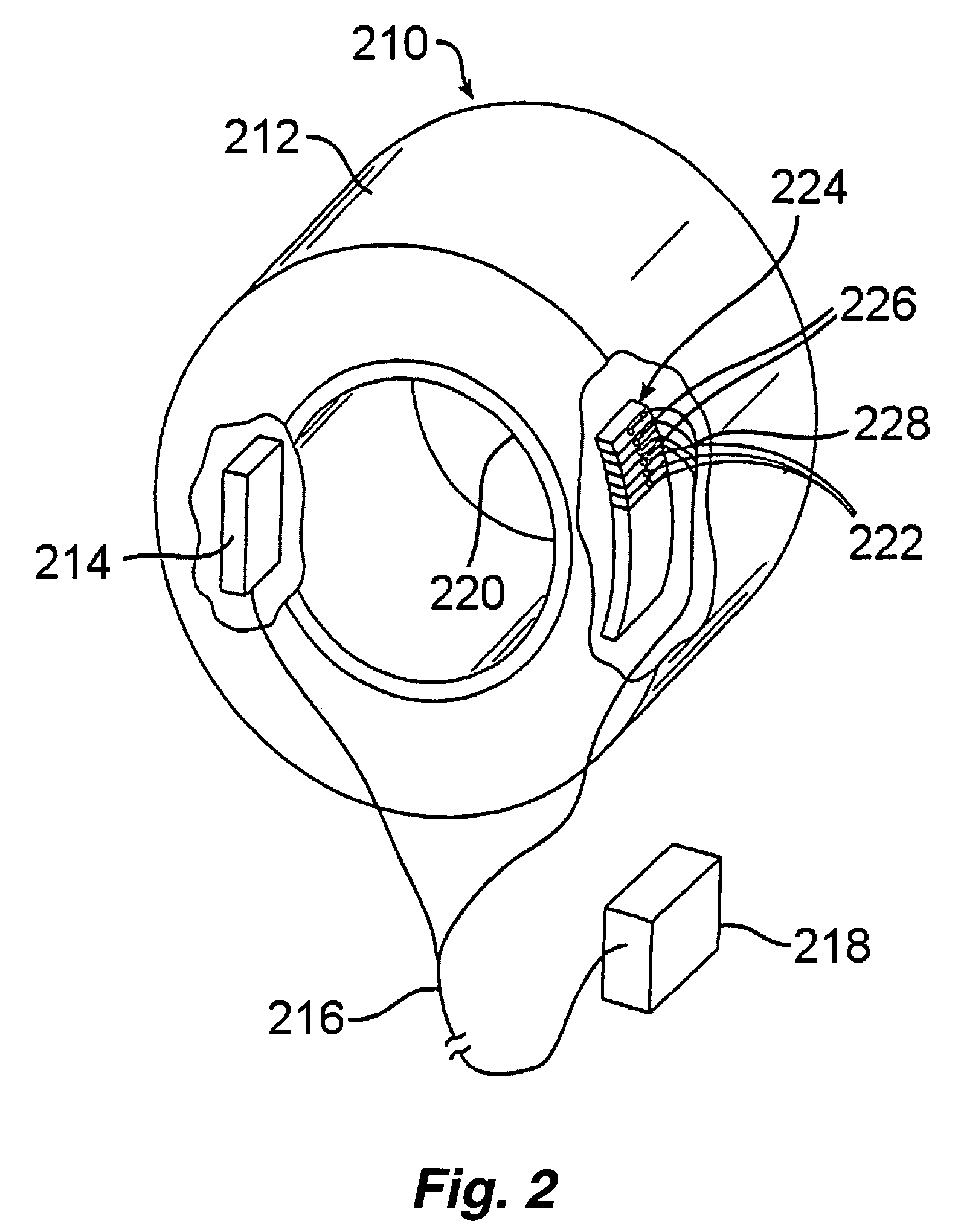 Doped cadmium tungstate scintillator with improved radiation hardness