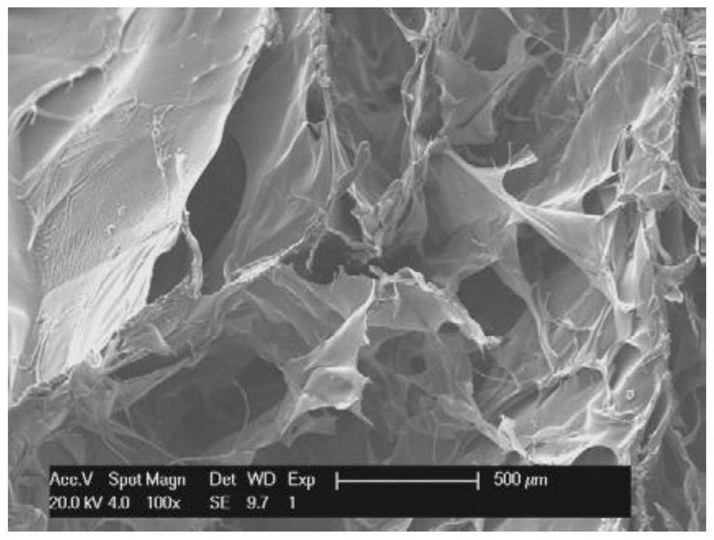 Tannic acid cross-linked chitosan/gelatin liquid-absorbing hemostatic antibacterial sponge and preparation method thereof