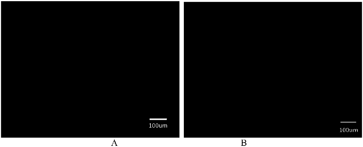 Articular cartilage repairing material based on oxidized hyaluronic acid-type II collagen and autologous concentration bone marrow nucleated cells and preparation method