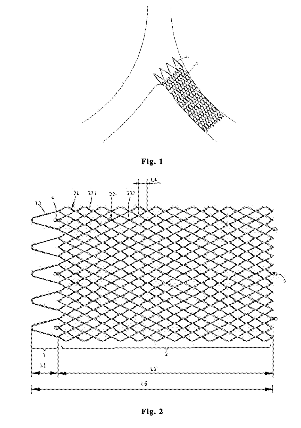 Intravascular stent, preparation method and use thereof