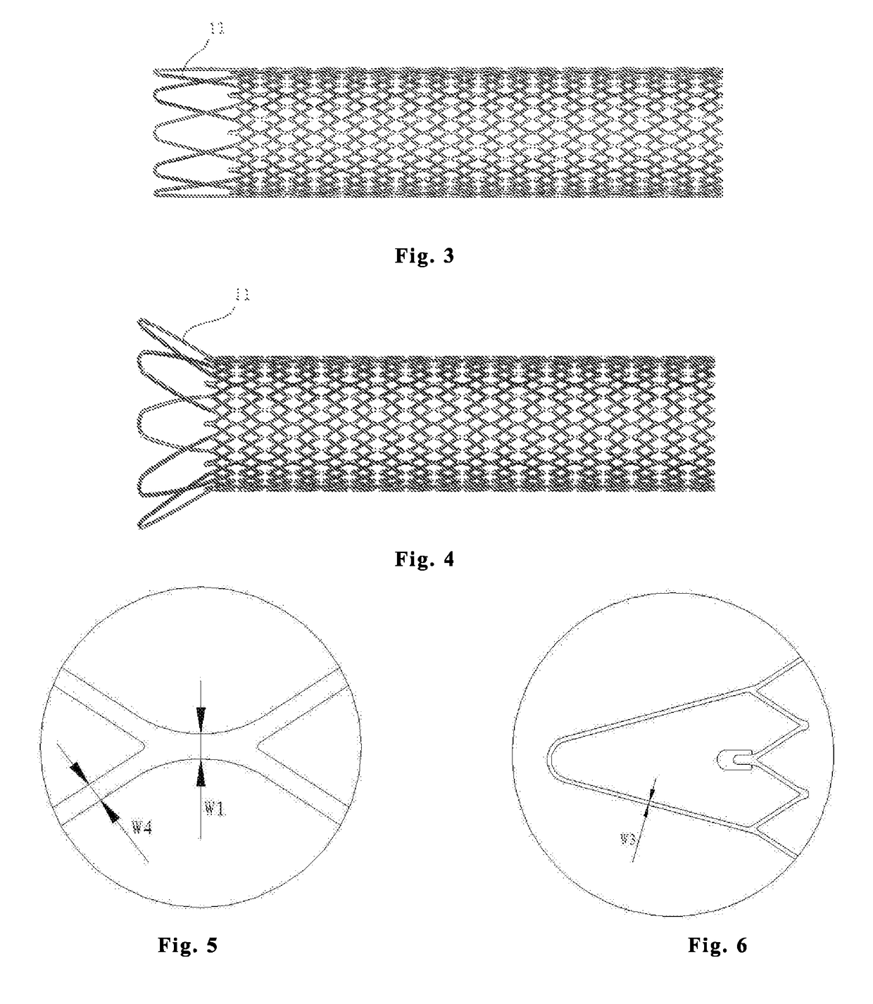 Intravascular stent, preparation method and use thereof