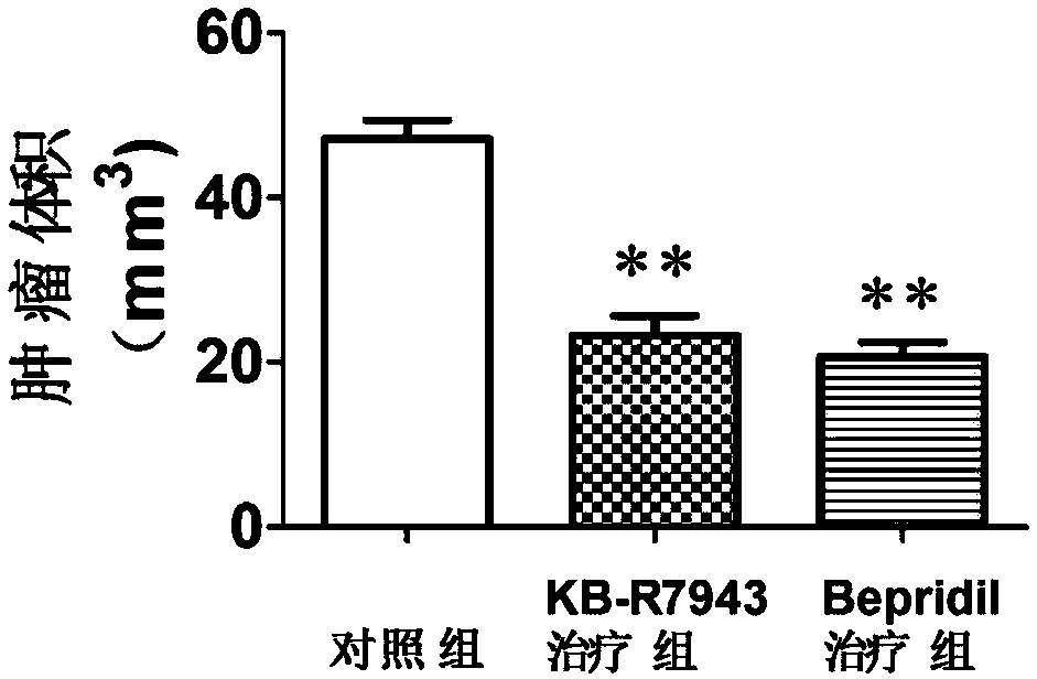 Application of KB-R7943 or Bepridil in preparing medicine for treating gliomas