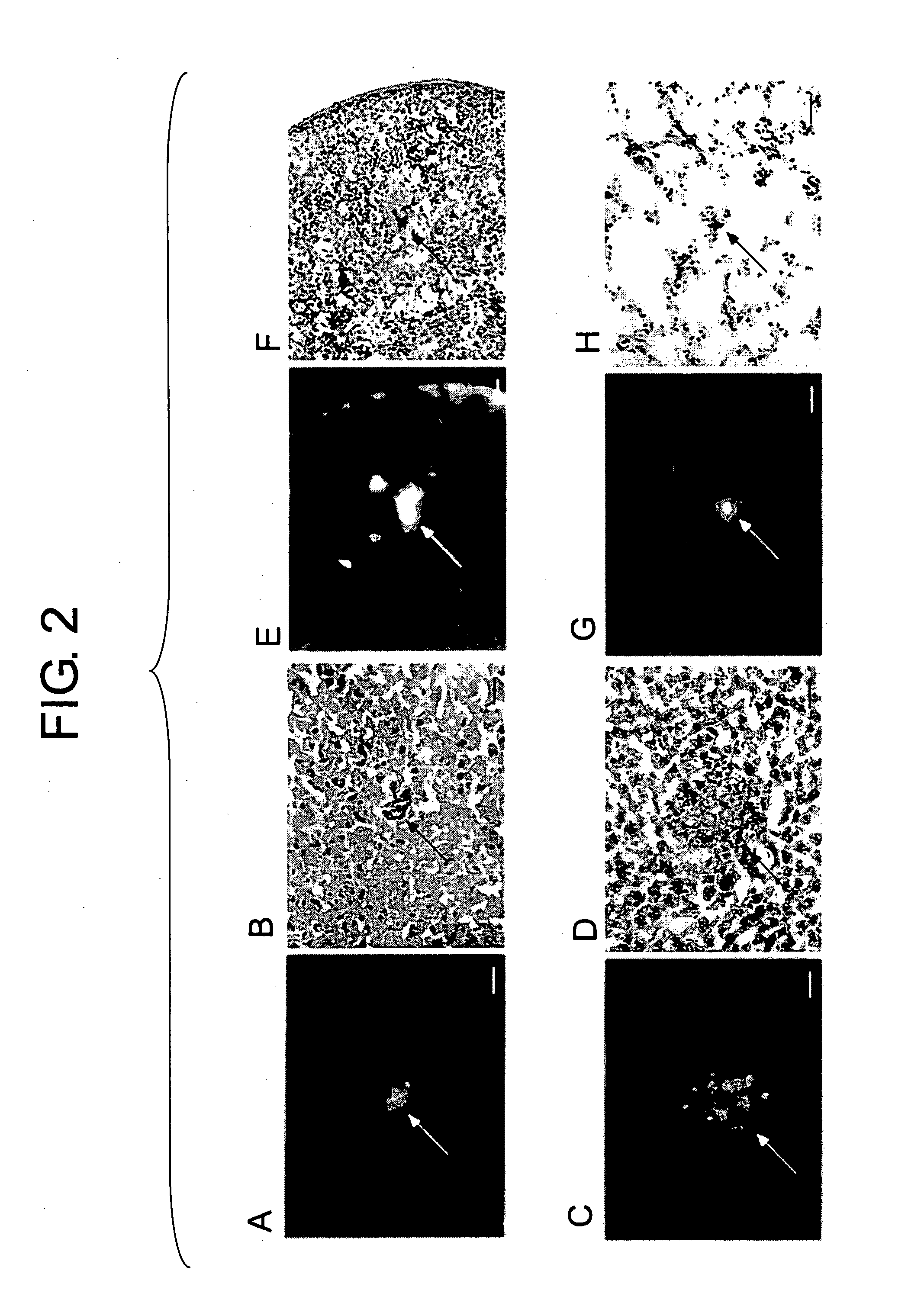 Brain-Localizing Bone Marrow Progenitor cells