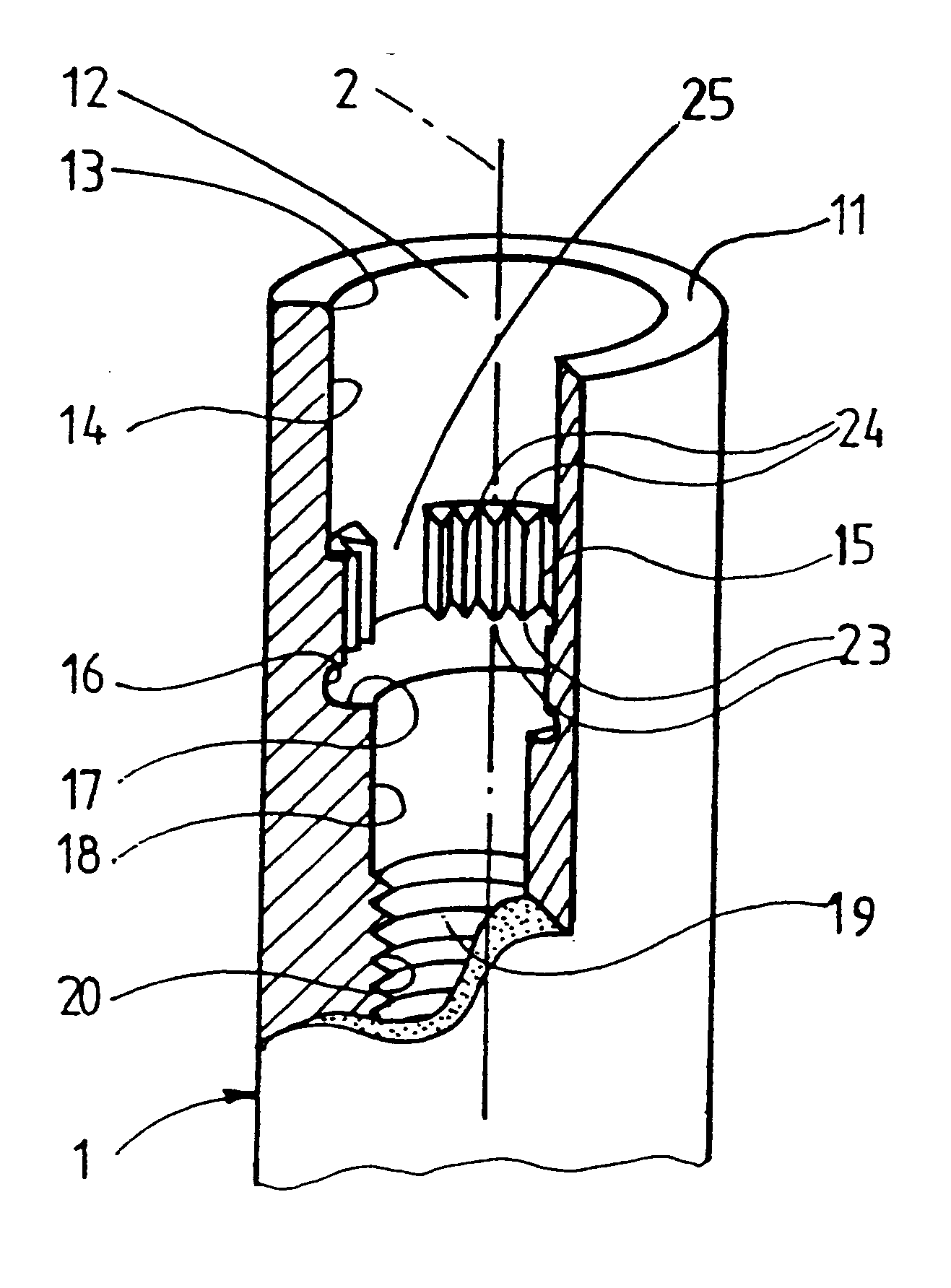 Dental implant and device with a dental implant