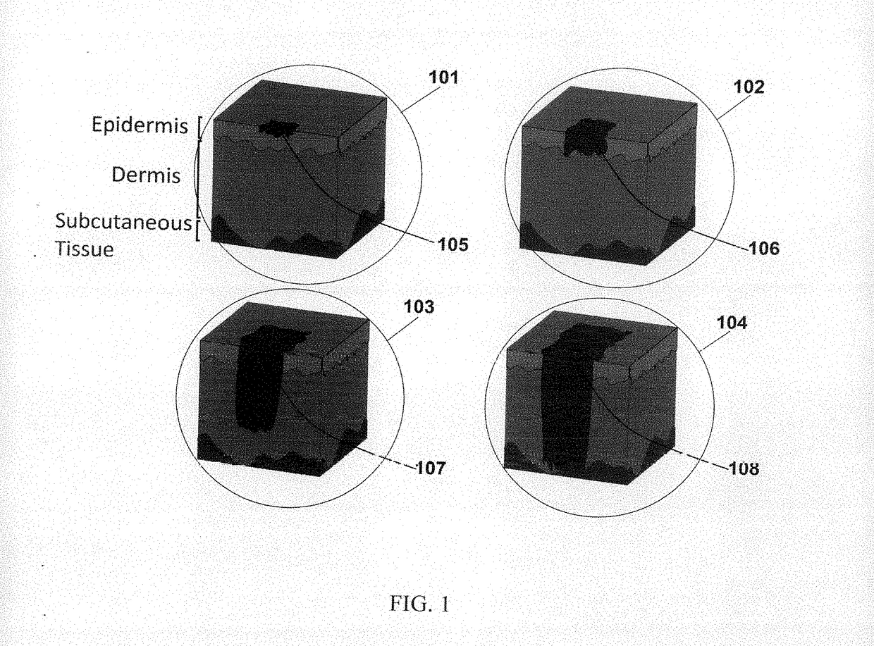 Imaging skin cancer detection device