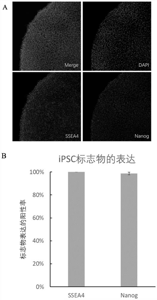 A method for preparing high-purity induced pluripotent stem cell-derived human brain dopaminergic neurons